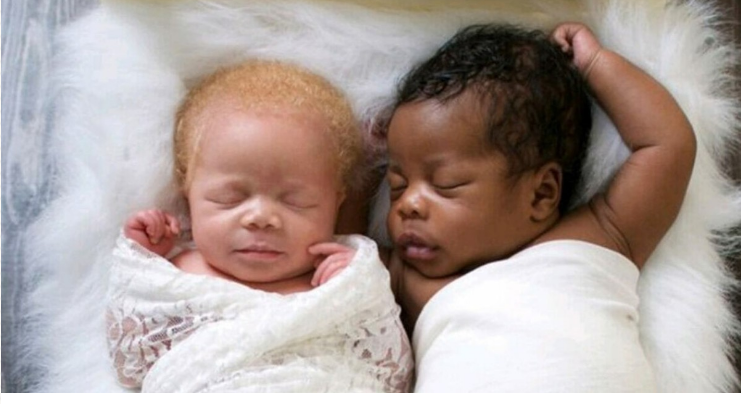 So different and so close: what adult twins look like