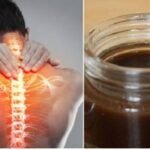 Սենսացիա․․․Այս քսուքը բուժում է ողնաշարի ճողվածքը, ուղղակի ամեն երեկո պառկելուց առաջ քսեք այն ողնաշարին